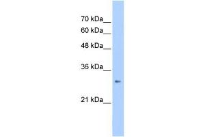 WB Suggested Anti-ING1 Antibody Titration:  2. (ING1 Antikörper  (C-Term))
