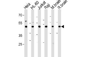 Western blot analysis in Hela,HL-60,Jurkat,Raji cell line and mouse brain,rat brain tissue lysates (35ug/lane). (CTBP1 Antikörper  (C-Term))
