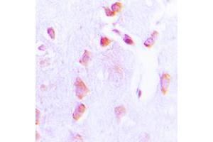Immunohistochemical analysis of BCL2 (pT69) staining in human brain formalin fixed paraffin embedded tissue section. (Bcl-2 Antikörper  (pSer69))