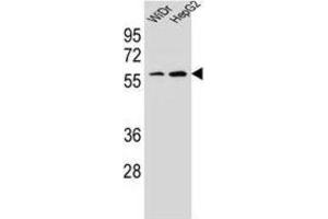 Western Blotting (WB) image for anti-Homeobox A10 (HOXA10) antibody (ABIN2995594) (HOXA10 Antikörper)