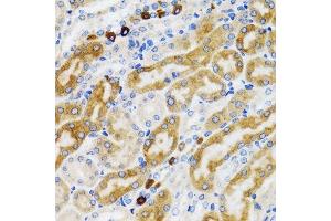 Immunohistochemistry (Paraffin-embedded Sections) (IHC (p)) image for anti-Progesterone Receptor Membrane Component 1 (PGRMC1) (AA 44-195) antibody (ABIN6145520)