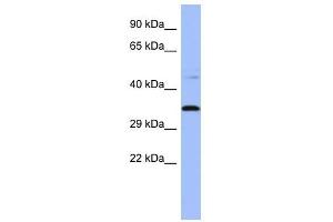 PYCR1 antibody used at 1 ug/ml to detect target protein. (PYCR1 Antikörper  (Middle Region))