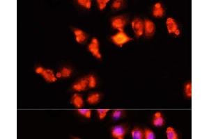 Immunofluorescence analysis of HeLa cells using HOXA11 Polyclonal Antibody at dilution of 1:100 (40x lens). (Homeobox A11 Antikörper)