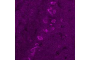 Immunohistochemistry (IHC) image for anti-Corticotropin Releasing Hormone (CRH) antibody (ABIN7456207) (CRH Antikörper)