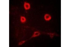 Immunofluorescent analysis of CD212 staining in MCF7 cells.