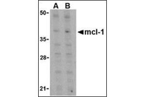 Western blot analysis of Mcl-1 in Raji cell lysates with this product at (A) 1 and (B) 2 μg/ml. (MCL-1 Antikörper  (C-Term))