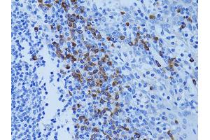 Immunohistochemistry of paraffin-embedded human tonsil using ATG7 antibody. (ATG7 Antikörper)
