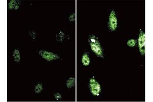 Immunofluorescent labelling of phosphorylated Stat6 in endothelial cells exposed to 10 ng/ml IL-4 for 1 hour.
