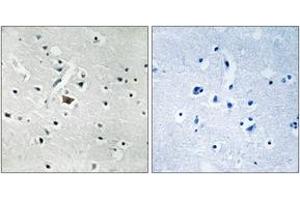 Immunohistochemistry analysis of paraffin-embedded human brain, using PLD2 (Phospho-Tyr169) Antibody. (Phospholipase D2 Antikörper  (pTyr169))