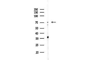 Western blot analysis of lysates from Hela cells(starvation,24h treatment), using HGFAC Antibody at 1/1000 dilution.