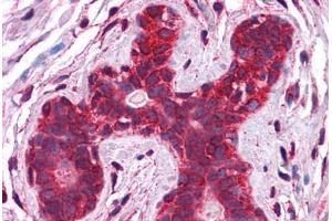Human Breast: Formalin-Fixed, Paraffin-Embedded (FFPE) (Calreticulin Antikörper  (AA 342-391))