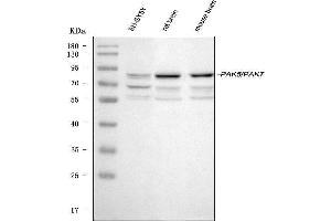 Western blot analysis of PAK5 using anti-PAK5 antibody (ABIN3043895).