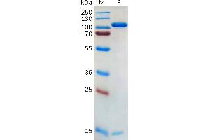 SDS-PAGE (SDS) image for Proprotein Convertase Subtilisin/kexin Type 9 (PCSK9) (AA 31-692) protein (Fc Tag) (ABIN7092725)