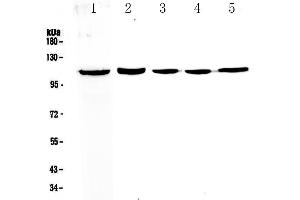 Western blot analysis of CP110 using anti-CP110 antibody . (CP110 Antikörper  (AA 51-284))