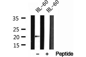 Western blot analysis of extracts of HL-60 cells, using Centrin 1 antibody.