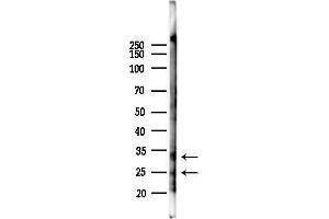 anti-MYST/Esa1-Associated Factor 6 (MEAF6) antibody