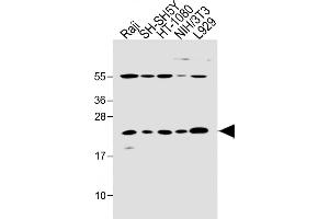 All lanes : Anti-Bax Antibody (BH3 Domain Specific) at 1:2000 dilution Lane 1: Raji whole cell lysate Lane 2: SH-SH5Y whole cell lysate Lane 3: HT-1080 whole cell lysate Lane 4: NIH/3T3 whole cell lysate Lane 5:  whole cell lysate Lysates/proteins at 20 μg per lane. (BAX Antikörper  (AA 41-76))