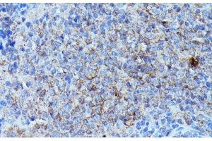 Immunohistochemistry of paraffin-embedded Rat spleen using CSF3 Polyclonal Antibody at dilution of 1:100 (40x lens). (G-CSF Antikörper)