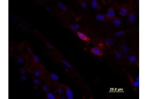 Formalin-fixed and paraffin embedded Human testis tissue labeled with unconjugated Anti-CD163/M130 Polyclonal Antibody, unconjugated  at 1:100 for 40 minutes at 37°C followed by labeling Donkey Anti-Rabbit, Cy3 conjugated 1:300, 60 minutes at 37°C. (CD163 Antikörper  (AA 1001-1121))