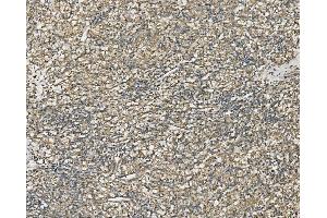 IHC analysis of NDUFB10 using anti-NDUFB10 antibody (ABIN7601461).