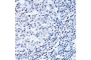 Immunohistochemistry of paraffin-embedded human appendix using PARP1 antibody. (PARP1 Antikörper  (AA 81-390))