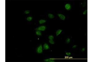 Immunofluorescence of monoclonal antibody to CDK5RAP3 on HeLa cell. (CDK5RAP3 Antikörper  (AA 1-506))