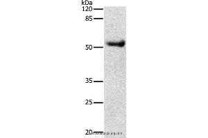 Western blot analysis of Human liver cancer tissue, using DRD4 Polyclonal Antibody at dilution of 1:600 (DRD4 Antikörper)