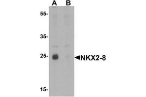 Western blot analysis of NKX2-8 in rat liver tissue lysate with NKX2-8 antibody at 1 ug/mL in (A) the absence and (B) the presence of blocking peptide (NKX2-8 Antikörper  (Middle Region))