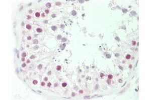 Anti-MEN1 / MENIN antibody IHC staining of human testis.