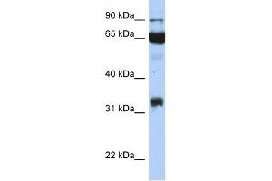 PTGS1 antibody used at 1 ug/ml to detect target protein. (PTGS1 Antikörper  (Middle Region))