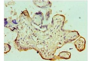 Immunohistochemistry of paraffin-embedded human placenta tissue using ABIN7171052 at dilution of 1:100 (SMARCC1 Antikörper  (AA 80-320))