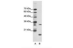 Image no. 1 for anti-MYC Associated Factor X (MAX) (C-Term) antibody (ABIN203016) (MAX Antikörper  (C-Term))