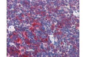 IHC Image for AP22588PU-N Mouse Spleen (formalin-fixed, paraffin-embedded) stained with M6PRBP1followed by biotinylated anti-goat IgG secondary antibody LS-D3, alkaline phosphatase-streptavidin and chromogen. (PLIN3 Antikörper  (Internal Region))