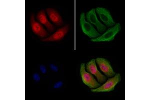 ABIN6255391 and ABIN6267252 staining Hela cells(4h of LPS treatment) by IF/ICC. (CHEK2 Antikörper  (pSer516))