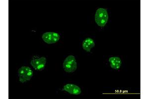 Immunofluorescence of monoclonal antibody to FBL on HeLa cell. (Fibrillarin Antikörper  (AA 1-321))