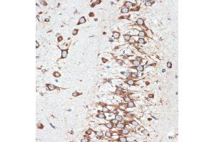 Immunohistochemistry of paraffin-embedded rat brain using LM Rabbit mAb (ABIN7268205) at dilution of 1:100 (40x lens).