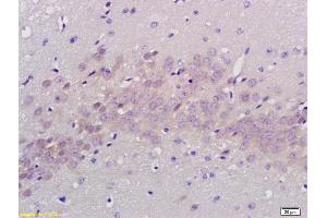Formalin-fixed and paraffin embedded rat brain labeled with Anti PABP Polyclonal Antibody, Unconjugated (ABIN704786) at 1:200 followed by conjugation to the secondary antibody and DAB staining (PABP Antikörper  (AA 101-200))