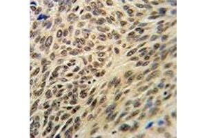 Immunohistochemistry (IHC) image for anti-X-Ray Repair Complementing Defective Repair in Chinese Hamster Cells 6 (XRCC6) (AA 521-548) antibody (ABIN3029655)