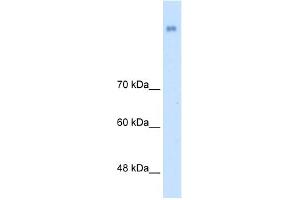 WB Suggested Anti-NRCAM Antibody Titration:  2. (NrCAM Antikörper  (N-Term))
