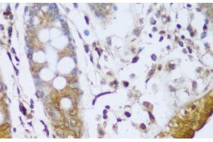 Immunohistochemistry of paraffin-embedded Human colon using GCC2 Polyclonal Antibody at dilution of 1:150 (40x lens). (GCC2 Antikörper)