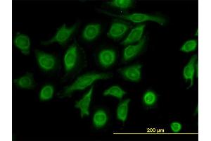 Immunofluorescence of monoclonal antibody to TIMP2 on HeLa cell. (TIMP2 Antikörper  (AA 27-220))