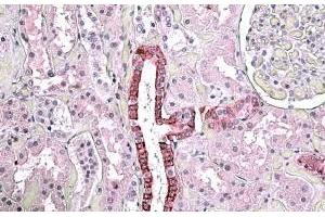 ABIN571098 (3. (TGFBI Antikörper  (Internal Region))