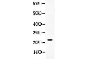 Anti-IL-18 Picoband antibody, All lanes: Anti-IL18  at 0. (IL-18 Antikörper  (AA 37-193))