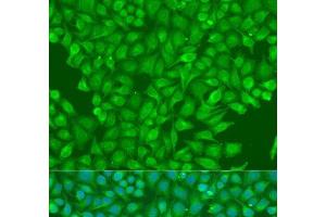 Immunofluorescence analysis of U2OS cells using CBL Polyclonal Antibody at dilution of 1:100. (CBL Antikörper)