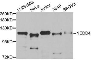 Western blot analysis of extracts of C6 cells tissue, using NEDD4 antibody.