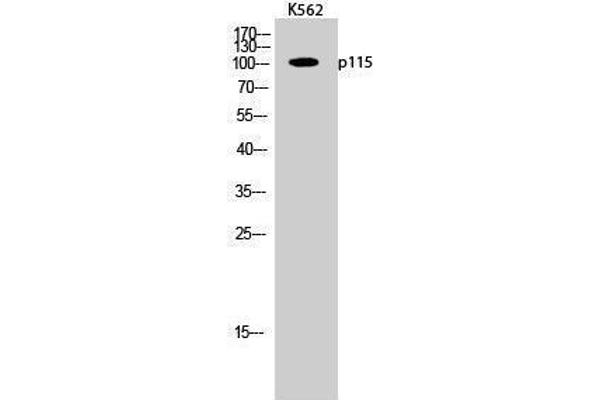 ARHGAP4 antibody  (C-Term)