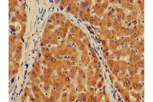 Immunohistochemistry of paraffin-embedded human liver tissue using ABIN7163717 at dilution of 1:100 (PLXND1 Antikörper  (AA 1-222))