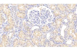 Detection of HLA-DRA in Human Kidney Tissue using Polyclonal Antibody to HLA Class II Histocompatibility Antigen, DR Alpha Chain (HLA-DRA) (HLA-DRA Antikörper  (AA 27-216))