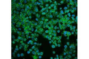 IF analysis of ASS1 using anti-ASS1 antibody (ABIN7601190). (ASS1 Antikörper  (AA 3-365))