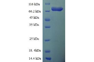 SDS-PAGE (SDS) image for Epoxide Hydrolase 2, Cytoplasmic (EPHX2) (AA 1-555), (full length) protein (His-SUMO Tag) (ABIN5709475)